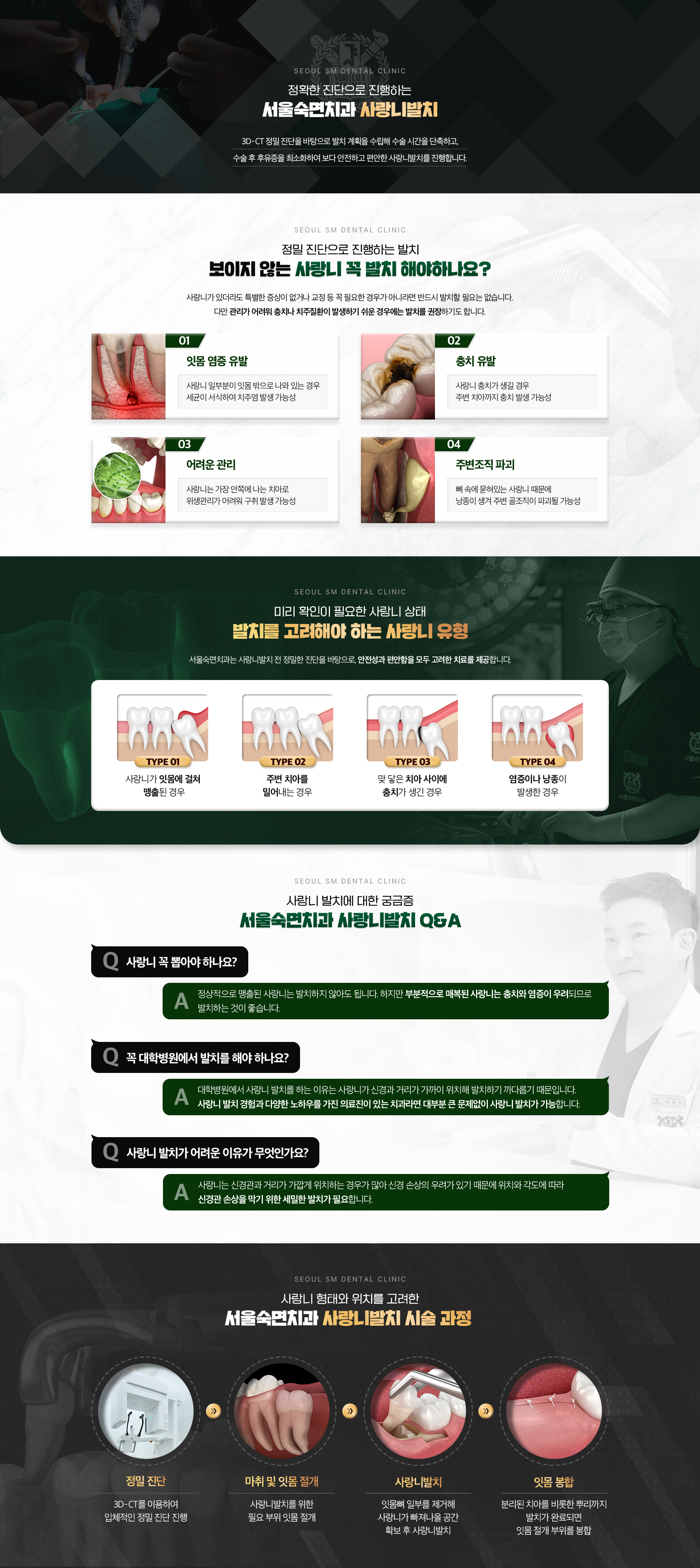 정확한 진단으로 진행하는-서울숙면치과 사랑니발치-보이지 않는 사랑니 꼭 발치 해야하나요?-서울숙면치과 사랑니발치 Q&A