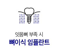뼈이식 임플란트