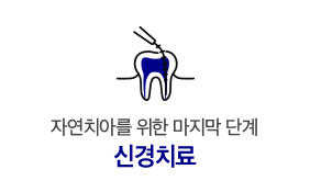 신경치료
