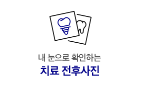 전후사진