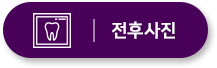 전후사진